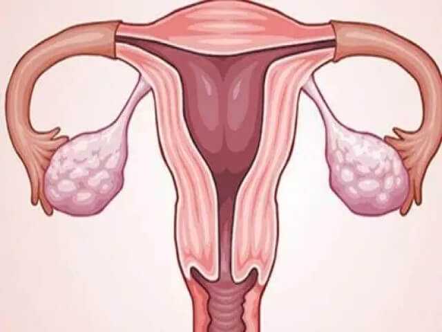 女性宫口紧试管移植时需要扩开宫颈